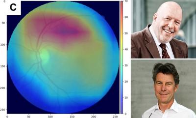 Le dépistage de la peau du réseau d'IA montre un risque cardiovasculaire