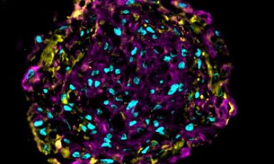 Les organes cardiaques avec système immunitaire montrent la cardiotoxicité