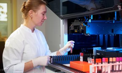 Même les valeurs d'acide urique "normales" mettent en danger le cœur et les vaisseaux, en particulier chez les femmes