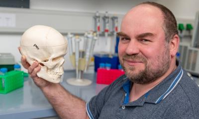 Craniosynostose : rechercher les causes de la fermeture des sutures crâniennes