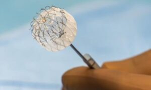 Occluseur ou médicament ? Les options pour la fibrillation auriculaire mises à l&rsquo;épreuve