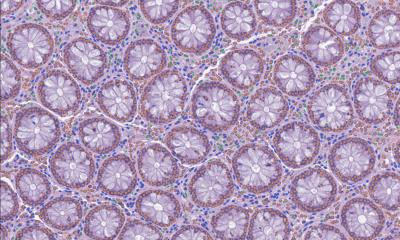 Pathologie numérique : de la coupe de tissus à la source de données
