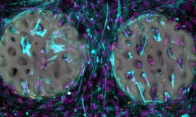 Un hydrogel – l’implant osseux du futur ?