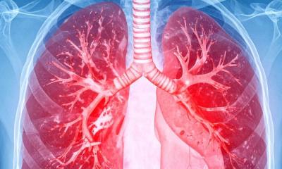 Embolie pulmonaire : l'échographie et le cathéter battent le traitement standard