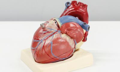 Insérer une pompe cardiaque – peu invasive au lieu d’une intervention chirurgicale majeure