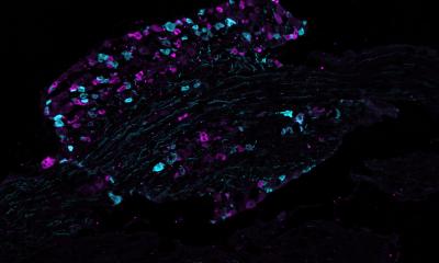 Mieux comprendre les mécanismes moléculaires de la douleur inflammatoire chronique
