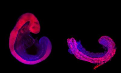 Recherche sur les embryons : l'éthique au-delà des listes de contrôle