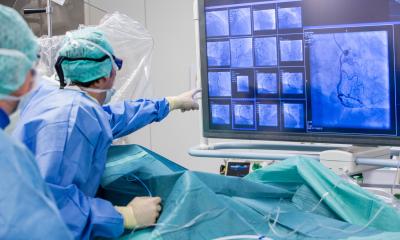 Réduire le risque de saignement grave après une chirurgie de stent cardiaque