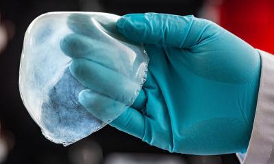 Remplacement de tissus imprimés en 3D pour les implants