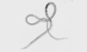 Découverte d&rsquo;une molécule clé dans la défense immunitaire contre les vers intestinaux