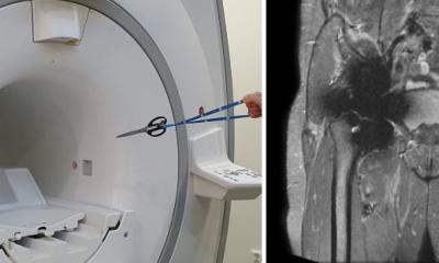 Des implants en IRM ? Pourquoi, sûrement !