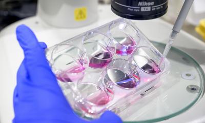 Encéphalite à IgLON5 : nouvelles connaissances sur les maladies auto-immunes graves