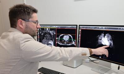 Faire progresser le diagnostic de la mucoviscidose grâce à l’IA