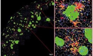 Les lymphocytes T comme moteurs de l&rsquo;inflammation dans la maladie d&rsquo;Alzheimer