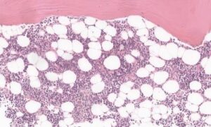 Sur les traces de la diversité des cellules souches sanguines