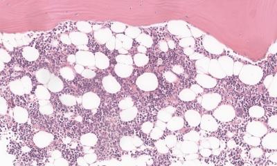 Sur les traces de la diversité des cellules souches sanguines