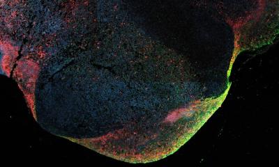 Comment Ebola se cache dans le corps après une infection