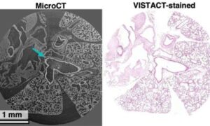 Coupes de tissus virtuelles 3D de CT