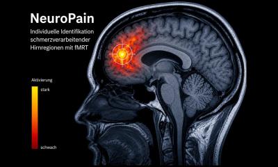Neuromodulation assistée par IRMf contre les maux de dos chroniques