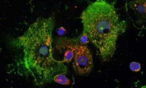 Asthme allergique : découverte d’un frein à une réaction immunitaire excessive
