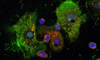 Asthme allergique : découverte d’un frein à une réaction immunitaire excessive