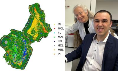 Diagnostic transparent par IA des lymphomes à cellules B