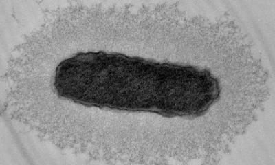 Hétérovirulence : une infection, plusieurs populations bactériennes