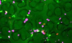 SARS-CoV-2 : Le système immunitaire des poumons réagit plus vite que prévu