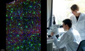Après l&rsquo;anesthésie : le cerveau des femmes récupère différemment