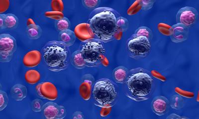 Cellules immunitaires : prêtes à être utilisées dans le cancer de la moelle osseuse (mais pas toujours)