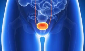Infections urinaires : nouvelle approche thérapeutique sans antibiotiques