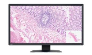 Moniteur spécifiquement développé pour la pathologie numérique