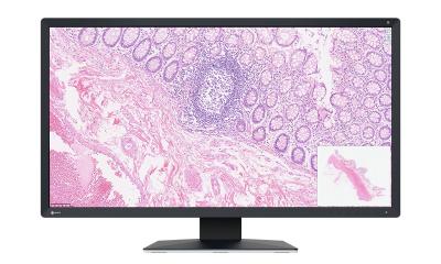 Moniteur spécifiquement développé pour la pathologie numérique