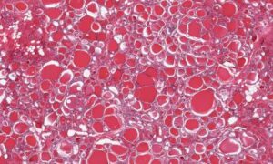 Une analyse de sang révèle quels organes vieillissent plus vite que d&rsquo;autres
