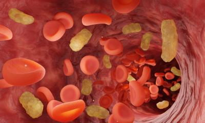 La détection précoce du sepsis grâce à l’IA pourrait éviter de nombreux décès