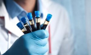 Maladies rares : de meilleurs diagnostics grâce à la protéomique et aux données génétiques