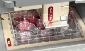 De nouveaux bioinks pour l’impression 3D d’organes
