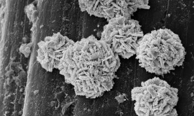 Diabète de type 2 : un implant électronique décompose le sucre dans le sang