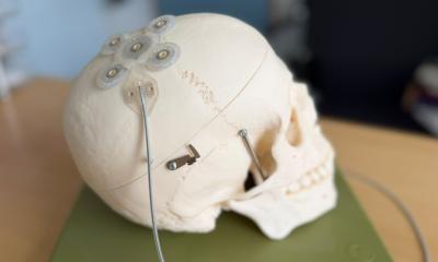 Épilepsie : l’IA devrait améliorer le traitement par stimulateurs cérébraux