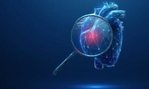 Insuffisance cardiaque : l&rsquo;IRM révèle des modifications du muscle cardiaque