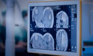 Radiothérapie : une nouvelle approche protège les données des patients pendant la formation en IA