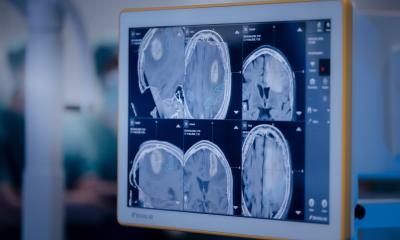 Radiothérapie : une nouvelle approche protège les données des patients pendant la formation en IA